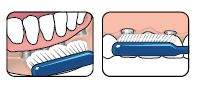 Cepillo TePe para Implantes y Ortodoncias