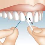Dispensador de hilo dental Mirafloss Implant chx - uso 1