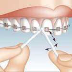 Dispensador de hilo dental Mirafloss Implant chx - uso 2